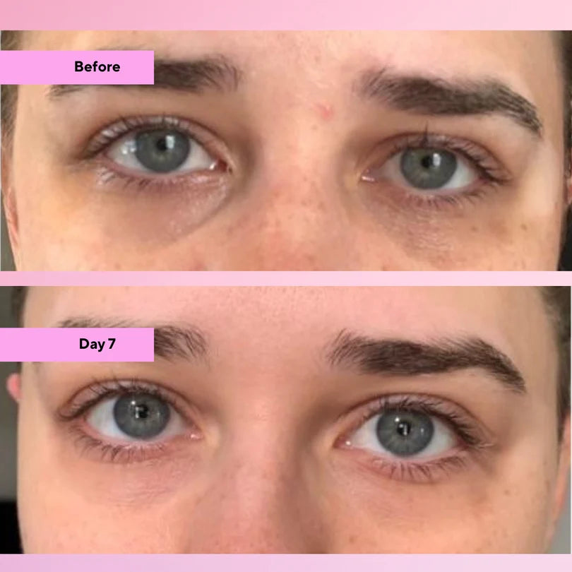 Illuminate V2 Multi‑Peptide Eye Serum | 15% Peptide System